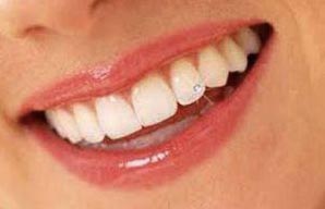 Soins dentaires en Hongrie